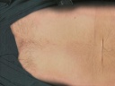 navel